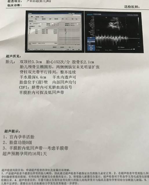无创亲子鉴定武汉哪里可以免费做?对孕妇和胎儿有伤害吗?