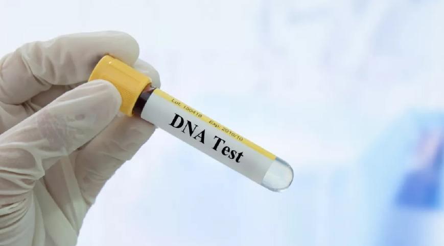 dna鉴定需要本人同意吗